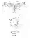 Fig. 30 - INTRA-ORAL LIGHT THERAPY APPARATUSES AND METHODS FOR THEIR USE