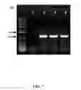 Fig. 09 - 1, 2-Dichloropropane-to-Propene Reductive Dehalogenase Genes