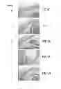 Fig. 11 - Connective tissue growth factor antibodies