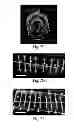 Fig. 12 - Methods and systems for scaffolds comprising nanoelectronic components