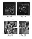Fig. 16 - Methods and systems for scaffolds comprising nanoelectronic components