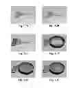 Fig. 20 - Methods and systems for scaffolds comprising nanoelectronic components
