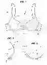 Fig. 02 - Breast Cup Core, Breast Cup, and Method of Making Same