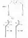Fig. 08 - Breast Cup Core, Breast Cup, and Method of Making Same