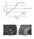 Fig. 06 - Large diameter cutting tool