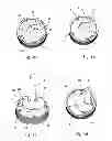Fig. 06 - Belt drive for a motor-driven tool