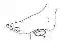 Fig. 01 - Exercise Device to Prevent DVT