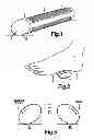 Fig. 02 - Exercise Device to Prevent DVT