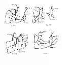 Fig. 41 - EXERCISE APPARATUS