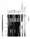Fig. 04 - Markers and methods for detecting posttraumatic stress disorder (PTSD)
