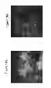 Fig. 23 - Targeting complement factor H for treatment of diseases
