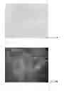 Fig. 18 - Potent and selective inhibitors of Na1.3 and Na1.7
