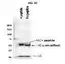 Fig. 93 - Potent and selective inhibitors of Na1.3 and Na1.7