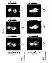 Fig. 11 - Compositions for the treatment of cancer, and methods for testing and using the same