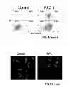 Fig. 04 - Compositions and methods including cell death inducers and procaspase activation