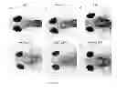 Fig. 09 - METHODS FOR DRUG SCREEN USING ZEBRAFISH MODEL AND THE COMPOUNDS SCREENED THEREFROM