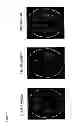 Fig. 06 - CONTROLLED RELEASE DELIVERY SYSTEM FOR NASAL APPLICATIONS AND METHODS OF TREATMENT