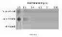 Fig. 04 - INHIBITION OF ANTIMICROBIAL TARGETS WITH REDUCED POTENTIAL FOR RESISTANCE