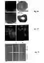 Fig. 03 - Treatment of Solid Tumours