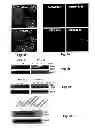 Fig. 07 - Treatment of Solid Tumours
