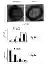 Fig. 12 - Treatment of Solid Tumours