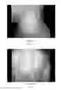 Fig. 02 - Treatment for vitiligo