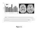Fig. 07 - Methods of treating alzheimer's disease and pharmaceutical compositions thereof