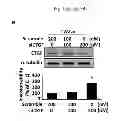 Fig. 06 - COMPOSITIONS FOR MODULATING INVASION ABILITY OF A TUMOR AND METHODS THEREOF