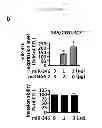 Fig. 08 - COMPOSITIONS FOR MODULATING INVASION ABILITY OF A TUMOR AND METHODS THEREOF