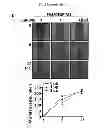 Fig. 09 - COMPOSITIONS FOR MODULATING INVASION ABILITY OF A TUMOR AND METHODS THEREOF