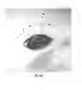 Fig. 63 - Posterior segment drug delivery
