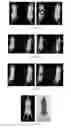 Fig. 07 - PSMA binding ligand-linker conjugates and methods for using