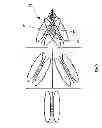 Fig. 06 - Device and methods for directing agents to the middle ear and the inner ear