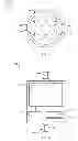 Fig. 06 - Mobility-enhancing blood pump system