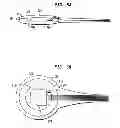 Fig. 07 - TET system for implanted medical device