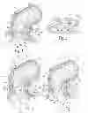 Fig. 02 - Method for treating fecal incontinence