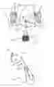 Fig. 01 - Incontinence treatment device