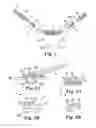 Fig. 02 - Implants, tools, and methods for treatment of pelvic conditions