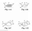Fig. 06 - Implants, tools, and methods for treatment of pelvic conditions