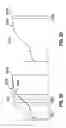 Fig. 55 - Remotely powered remotely adjustable gastric band system