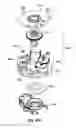 Fig. 65 - Remotely powered remotely adjustable gastric band system
