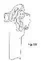 Fig. 28 - FORCE FEEDBACK CONTROL SYSTEM FOR VIDEO ENDOSCOPE