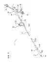 Fig. 02 - Catheter with imaging assembly with placement aid and related methods therefor