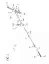 Fig. 03 - Catheter with imaging assembly with placement aid and related methods therefor