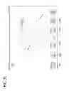 Fig. 33 - Catheter with imaging assembly with placement aid and related methods therefor