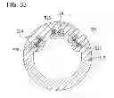 Fig. 36 - Catheter with imaging assembly with placement aid and related methods therefor