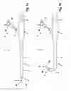 Fig. 02 - Shank for a flexible endoscope or a flexible endoscopic instrument