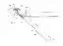 Fig. 01 - Robotic endoscopic retractor for use in minimally invasive surgery