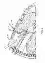 Fig. 02 - Robotic endoscopic retractor for use in minimally invasive surgery