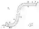 Fig. 01 - Gastric bougie/dilator with integral lighted tip